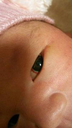 宝宝眼睛有红血丝是怎么回事