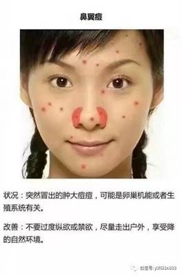 鼻翼冒痘痘