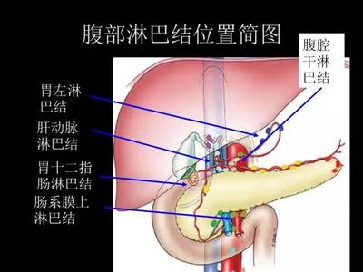 腹部淋巴结怎么治疗才能消除