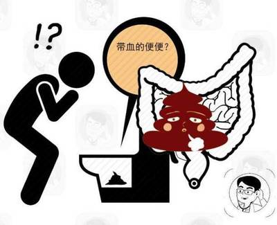 放屁多便血是怎么回事