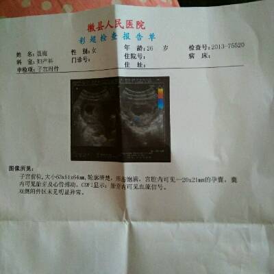 多少天会怀孕