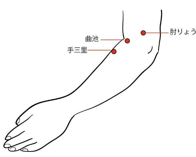 手臂发麻怎么治疗