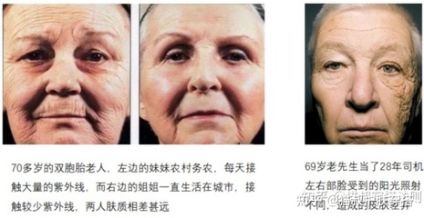 老年人适合用什么护肤品