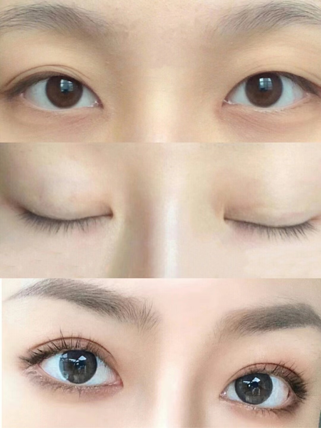 双眼皮什么时候贴