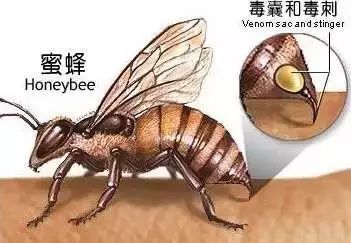 被马蜂蛰了怎么治疗