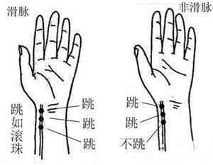 怀孕脉象图解