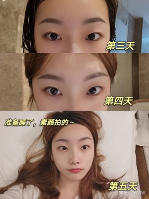 纹眉第四天