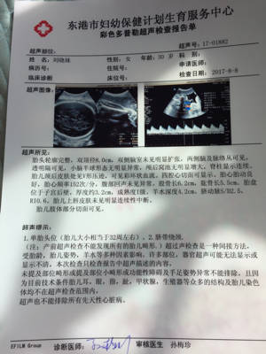 胎儿照片大全集32周