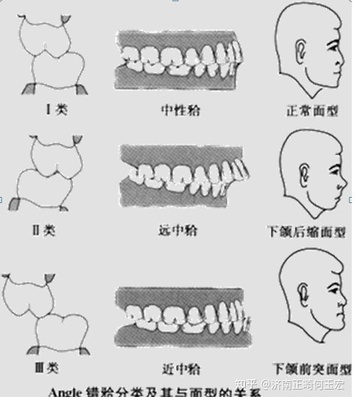 男人牙齿有缝隙面相