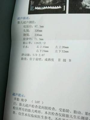 怀孕33周入盆正常吗