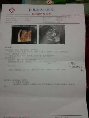 怀孕多久做nt和唐筛
