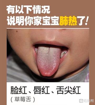 宝宝舌尖红是什么原因