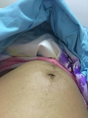8个月肚子隐隐作痛