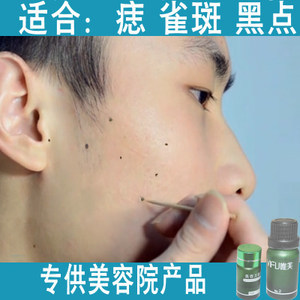 祛斑点斑水哪种最好