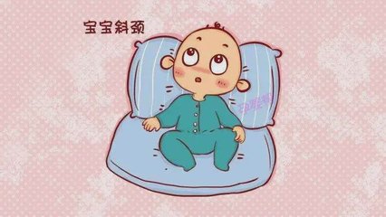 新生儿 斜颈