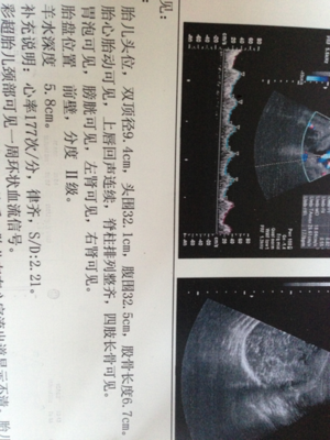 孕36周后胎儿一周一般能长重