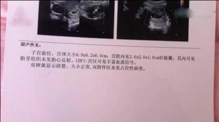 为什么很多八个月胎停