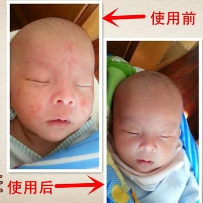 宝宝红屁股擦什么