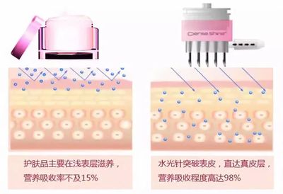 水光针能去皱纹吗