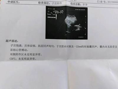 月经前三天会怀孕吗