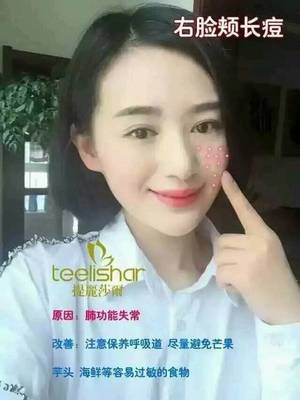 右脸颊为什么会长痘痘