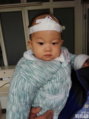 五个月宝宝出疹子怎么办