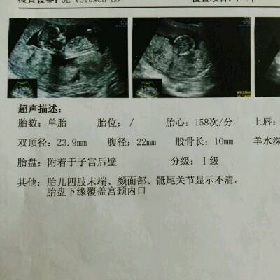 孕15周胎儿