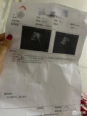怀孕几周能用验孕棒测出来