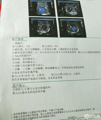 有必要做胎儿心脏彩超吗