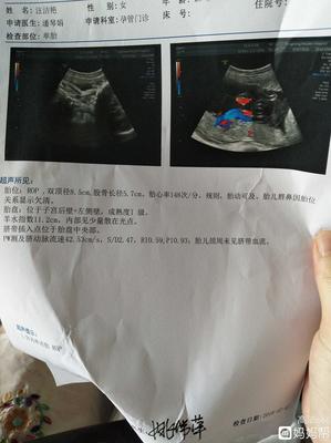孕三十三周是几个月