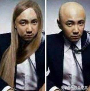 秃顶长发