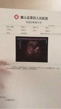 彩超 怀孕