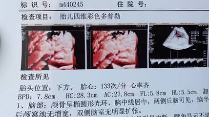 怀孕33周几个月