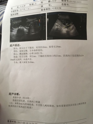 怀孕四个月胎盘低怎么办