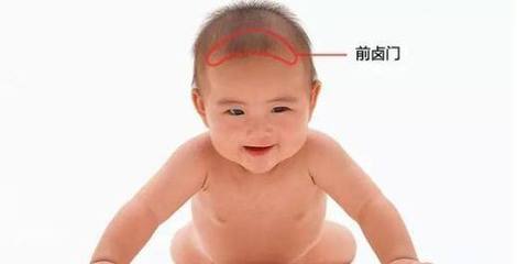 新生儿前卤门大小标准