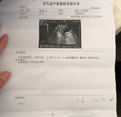 两个月胎儿图片