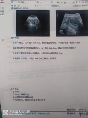 十七周的胎儿彩超图