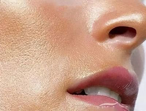 为什么脸部出油严重