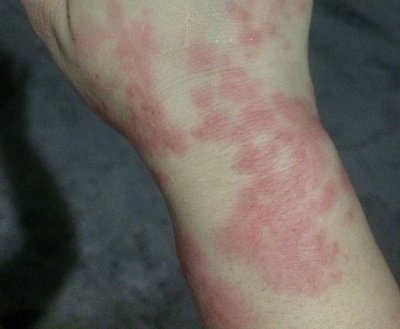 身上麻是怎么回事