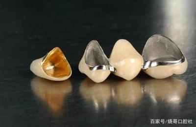 烤瓷牙酸痛