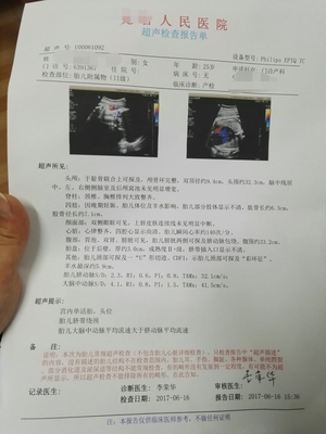 38周吸氧对胎儿好吗
