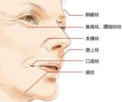 除皱原理