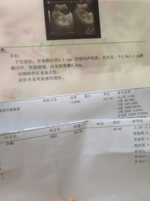 孕酮吃多了对胎儿有影响吗