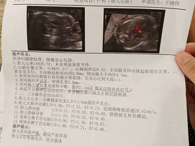 胎儿心脏彩超检查什么内容