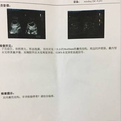 53岁月经停2个月又来了