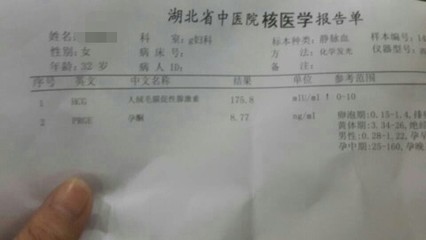怎么看怀孕没