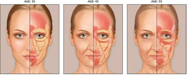 人的皮肤每年下垂多少钱