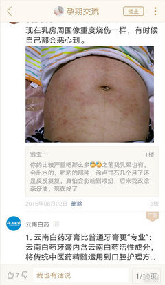 怀孕4周会恶心吗