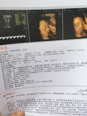 胎儿照片大全集32周