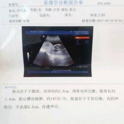 怀孕几个月能看出来男女
